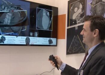 Xbox Kinect هنوز هم در سی‌تی اسکن بیمارستان کاربرد دارد